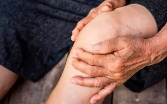 Persona con linfedema alle gambe utilizza un montascale per superare le scale senza sforzo.